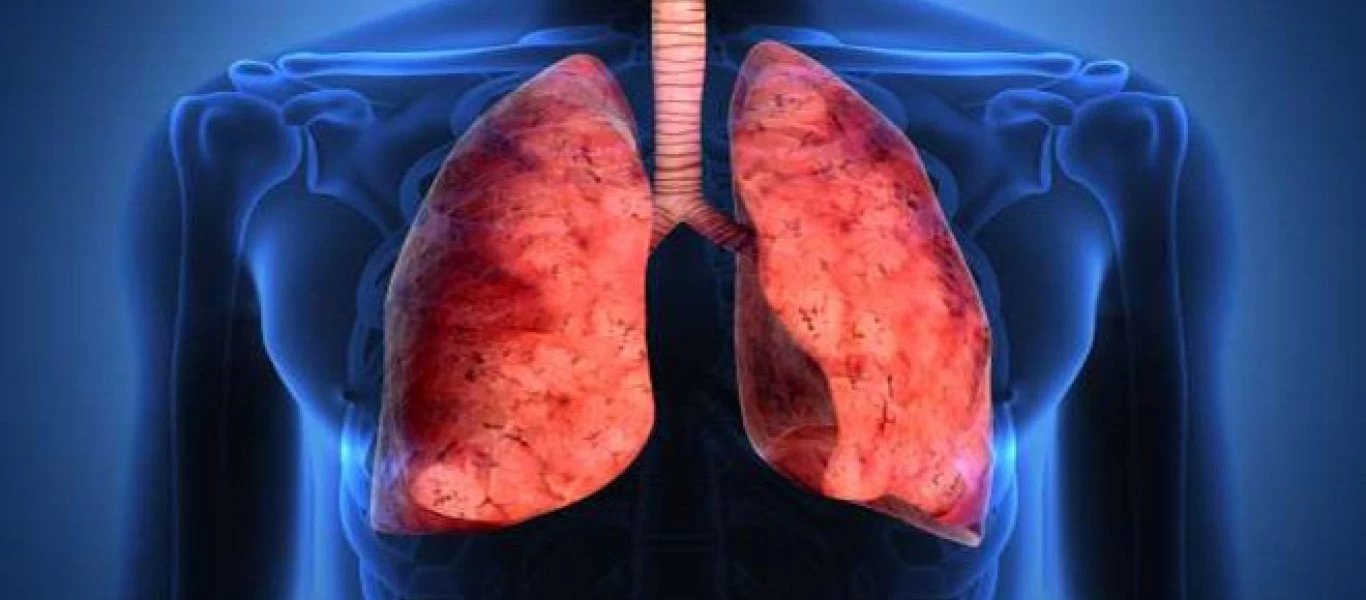 Αυτές είναι οι τροφές που «καθαρίζουν» τους πνεύμονες (βίντεο)